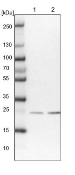 SSSCA1 Antibody, Novus Biologicals 0.1mL; Unlabeled:Antibodies, Polyclonal