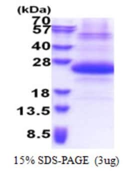 Novus Biologicals&trade;&nbsp;Recombinant Human SSSCA1 His Protein