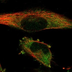 SSSCA1 Antibody, Novus Biologicals 0.1mL; Unlabeled:Antibodies, Polyclonal