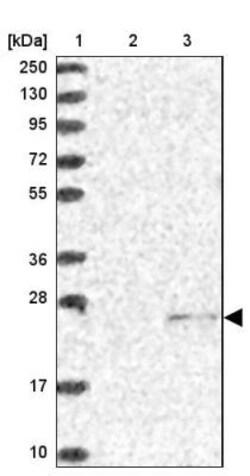 SSSCA1 Antibody, Novus Biologicals 0.1mL; Unlabeled:Antibodies, Polyclonal