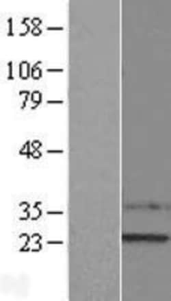 Novus Biologicals&trade;&nbsp;SSX1 Overexpression Lysate