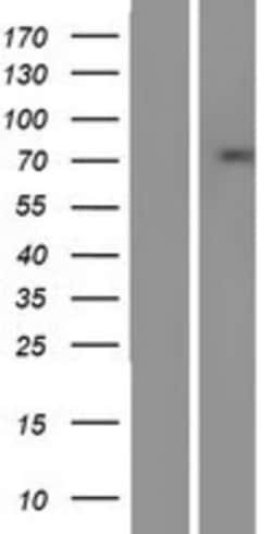 Novus Biologicals™ SSX2IP Overexpression Lysate