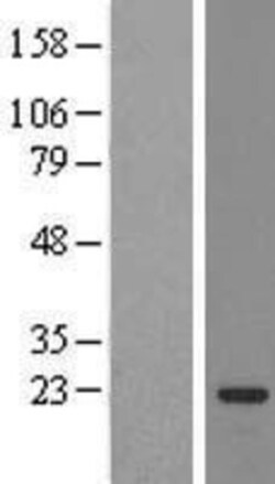 Novus Biologicals™ SSX3 Overexpression Lysate
