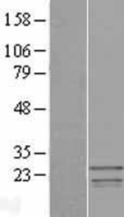 Novus Biologicals&trade;&nbsp;SSX3 Overexpression Lysate
