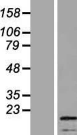 Novus Biologicals™ SSX4 Overexpression Lysate