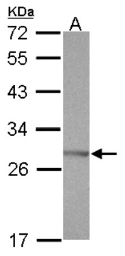 SSX5 Antibody, Novus Biologicals 0.1mL; Unlabeled:Antibodies, Polyclonal