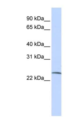 SSX6 Antibody, Novus Biologicals:Antibodies:Primary Antibodies