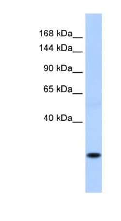 SSX8 Antibody, Novus Biologicals 100&mu;L; Unlabeled:Antibodies, Polyclonal