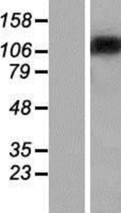 Novus Biologicals&trade;&nbsp;ST18 Overexpression Lysate