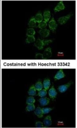 ST3 beta-Gal alpha-2,3-Sialyltransferase 1/ST3GAL1/SIAT4A Antibody, Novus