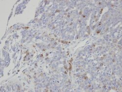 ST3 beta-Gal alpha-2,3-Sialyltransferase 1/ST3GAL1/SIAT4A Antibody, Novus