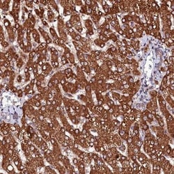 ST3 beta-Gal alpha-2,3-Sialyltransferase 1/ST3GAL1/SIAT4A Antibody, Novus