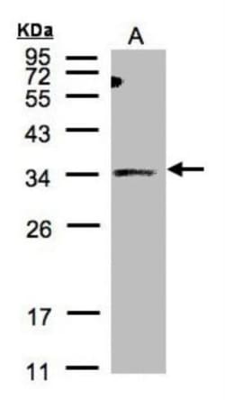 ST3 beta-Gal alpha-2,3-Sialyltransferase 1/ST3GAL1/SIAT4A Antibody, Novus