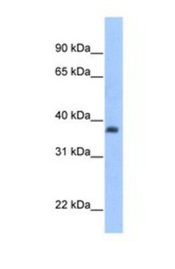 ST3 beta-Gal alpha-2,3-Sialyltransferase 2/ST3GAL2 Antibody, Novus Biologicals