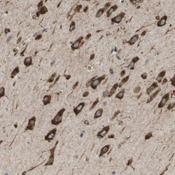 ST3 beta-Gal alpha-2,3-Sialyltransferase 2/ST3GAL2 Antibody, Novus Biologicals
