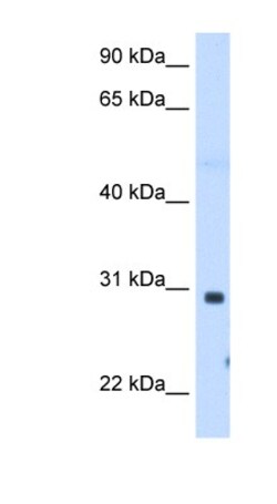 ST3GAL3 Antibody, Novus Biologicals 0.1mg; Unlabeled:Antibodies, Polyclonal