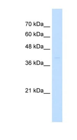 ST3GAL3 Antibody, Novus Biologicals:Antibodies:Primary Antibodies