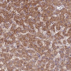 ST3GAL3 Antibody, Novus Biologicals 25 &mu;L, Unlabeled:Antibodies, Polyclonal