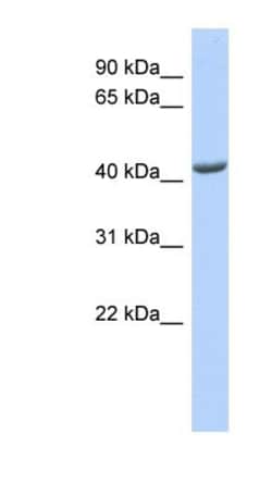 ST3GAL4 Antibody, Novus Biologicals:Antibodies:Primary Antibodies