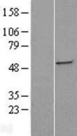 Novus Biologicals™ ST3GAL5 Overexpression Lysate