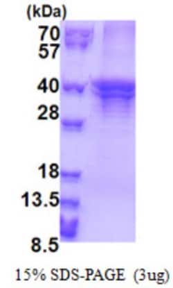 Novus Biologicals&trade;&nbsp;Recombinant Human ST3GAL5 His Protein