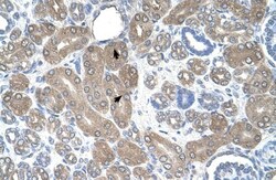 ST3GAL5 Antibody, Novus Biologicals 0.1mg; Unlabeled:Antibodies, Polyclonal