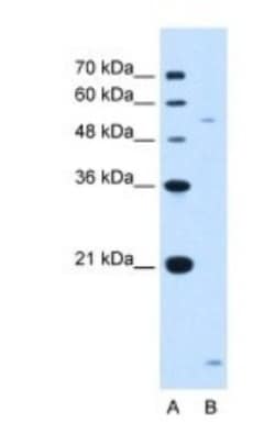 ST3GAL5 Antibody, Novus Biologicals 0.1mg; Unlabeled:Antibodies, Polyclonal