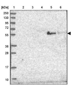 ST3GAL5 Antibody, Novus Biologicals 25 &mu;L, Unlabeled:Antibodies, Polyclonal
