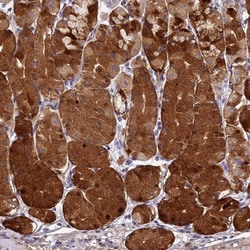 ST3GAL6 Antibody, Novus Biologicals 0.1 mL | Buy Online | Novus Biologicals | Fisher Scientific