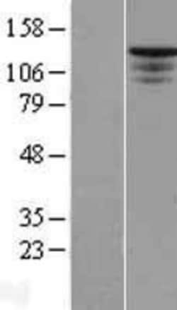 Novus Biologicals&trade;&nbsp;ST5 Overexpression Lysate