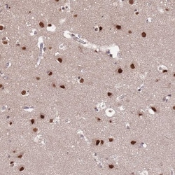 ST5 Antibody, Novus Biologicals 0.1mL; Unlabeled:Antibodies, Polyclonal