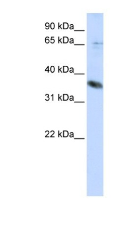 ST6GALNAC1 Antibody, Novus Biologicals 0.05mg; Unlabeled:Antibodies, Polyclonal