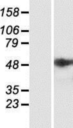 Novus Biologicals&trade;&nbsp;ST6 Sialyltransferase 2/ST6GALNAC2 Overexpression Lysate