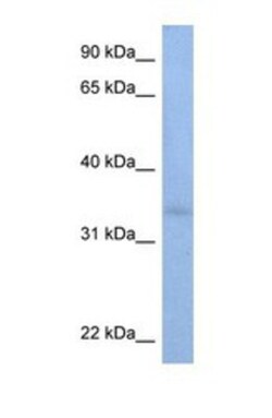 ST6GALNAC3 Antibody, Novus Biologicals 0.05mg; Unlabeled:Antibodies, Polyclonal