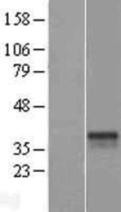 Novus Biologicals&trade;&nbsp;ST6GALNAC3 Overexpression Lysate