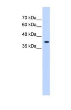 ST6 GalNAc alpha-2,6-sialyltransferaseV/ST6GALNAC5 Antibody, Novus Biologicals