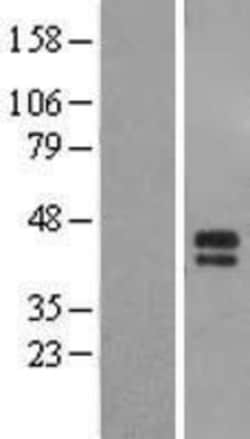 Novus Biologicals&trade;&nbsp;ST6 GalNAc alpha-2,6-sialyltransferaseV/ST6GALNAC5 Overexpression Lysate