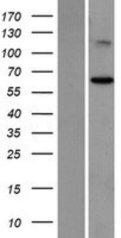 Novus Biologicals&trade;&nbsp;Suppression of Tumorigenicity 7 Overexpression Lysate