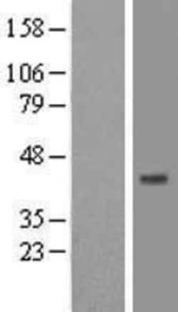 Novus Biologicals™ ST8 alpha-2,8-Sialyltransferase 8B/ST8SIA2 Overexpression Lysate