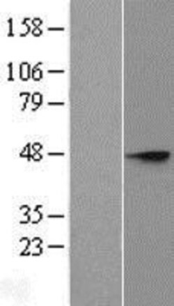 Novus Biologicals&trade;&nbsp;ST8SIA3 Overexpression Lysate