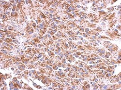 ST8 alpha-2,8-Sialyltransferase 4/ST8SIA4 Antibody, Novus Biologicals 0.1mL;