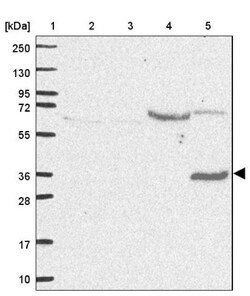 ST8 alpha-2,8-Sialyltransferase 4/ST8SIA4 Antibody, Novus Biologicals 0.1mL;