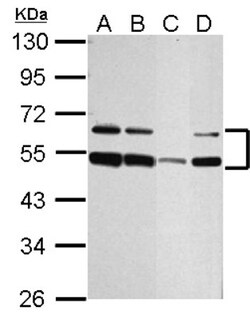 ST8 alpha-2,8-Sialyltransferase 4/ST8SIA4 Antibody, Novus Biologicals 0.1mL;