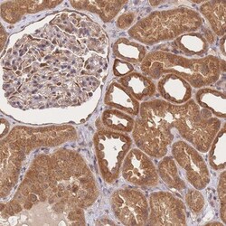 ST8 alpha-2,8-Sialyltransferase 4/ST8SIA4 Antibody, Novus Biologicals 0.1mL;