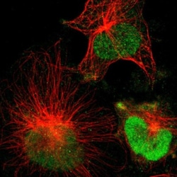 ST8SIA-VI Antibody, Novus Biologicals 0.1mL; Unlabeled:Antibodies, Polyclonal