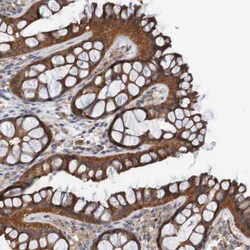 ST8SIA-VI Antibody, Novus Biologicals 0.1mL; Unlabeled:Antibodies, Polyclonal