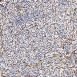Stabilin-2 Antibody, Novus Biologicals 0.1mL; Unlabeled:Antibodies, Polyclonal