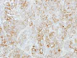 STAC Antibody, Novus Biologicals 0.1mL; Unlabeled:Antibodies, Polyclonal