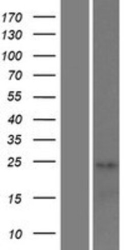 Novus Biologicals&trade;&nbsp;STAG3L1 Overexpression Lysate