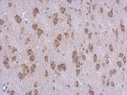 AMSH-LP Antibody, Novus Biologicals 0.1 mL | Buy Online | Novus Biologicals | Fisher Scientific
